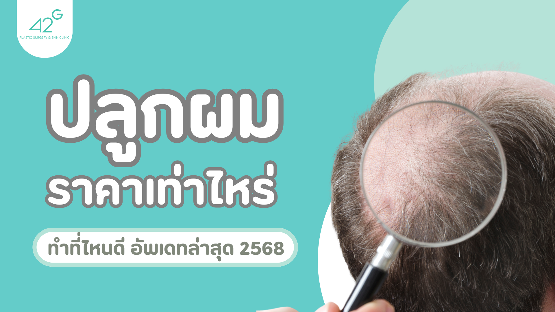 ปลูกผม ราคาเท่าไหร่ ทำที่ไหนดี