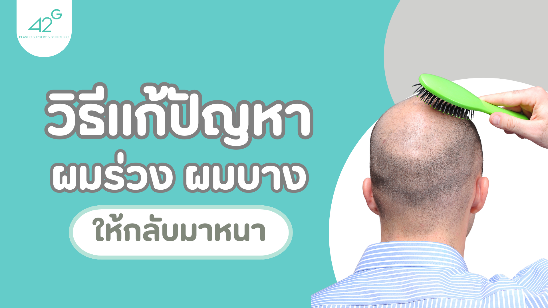 ผมร่วง ผมบาง